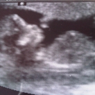 13 weken zwanger 