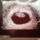 8 weken zwanger 2 weken geledeb zagen we dit! Allee klopte