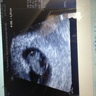  De eerste echo van ons wonder 
